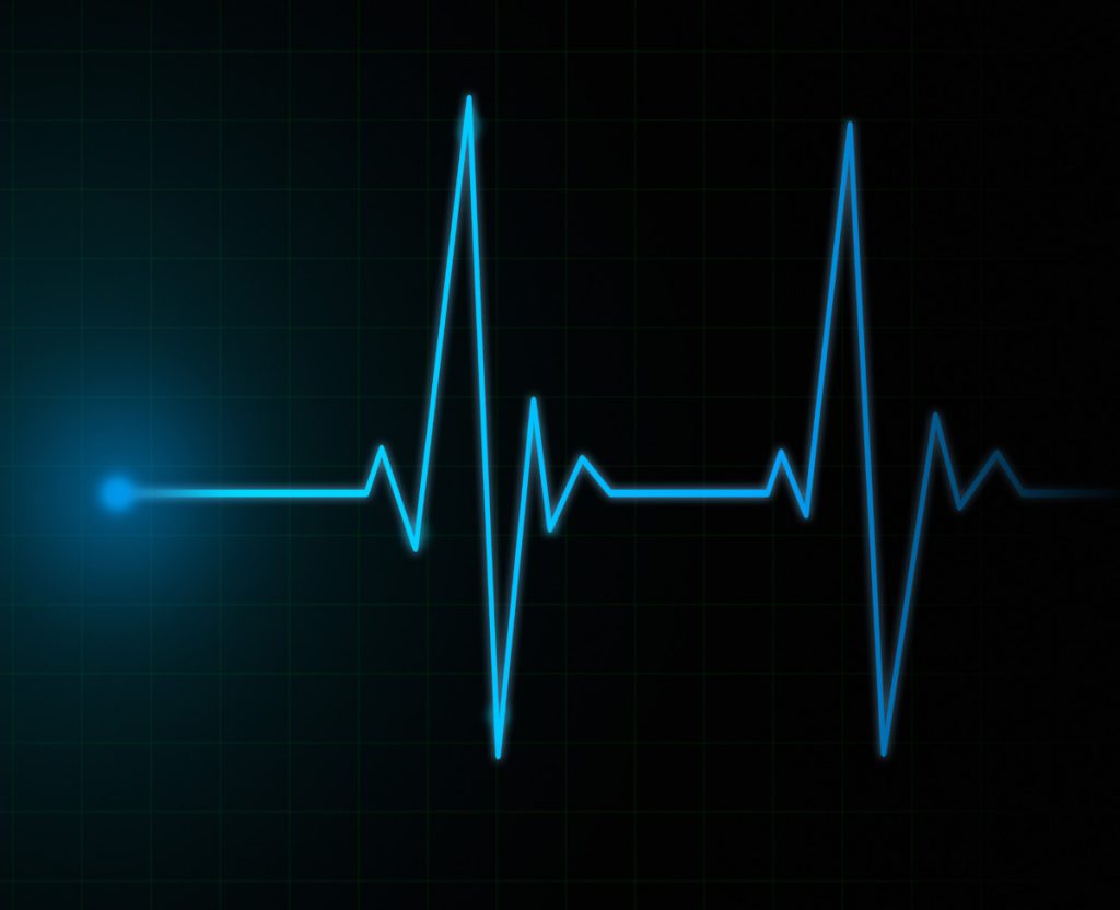 ECG in Farmacia